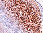 CD35/CR1 (Follicular Dendritic Cell Marker) Monoclonal Antibody (E11)