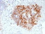CD35/CR1 (Follicular Dendritic Cell Marker) Monoclonal Antibody (CR1/6380)
