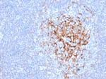 CD35/CR1 (Follicular Dendritic Cell Marker) Monoclonal Antibody (CR1/6383)