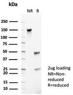 CD35/CR1 (Follicular Dendritic Cell Marker) Antibody in SDS-PAGE (SDS-PAGE)