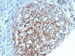 CD35/CR1 (Follicular Dendritic Cell Marker) Antibody in Immunohistochemistry (Paraffin) (IHC (P))