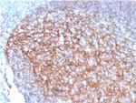 CD35/CR1 (Follicular Dendritic Cell Marker) Monoclonal Antibody (SPM554)
