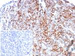 CD35/CR1 (Follicular Dendritic Cell Marker) Recombinant Mouse Monoclonal Antibody (rCR1/8596)