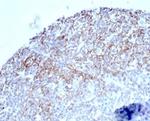 CD35/CR1 (Follicular Dendritic Cell Marker) Antibody in Immunohistochemistry (Paraffin) (IHC (P))