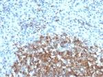 CD35/CR1 (Follicular Dendritic Cell Marker) Monoclonal Antibody (CR1/6377)