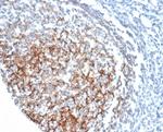 CD35/CR1 (Follicular Dendritic Cell Marker) Monoclonal Antibody (CR1/6378)