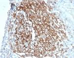 CD35/CR1 (Follicular Dendritic Cell Marker) Recombinant Rabbit Monoclonal Antibody (CR1/7016R)