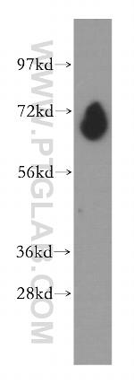 PDE1C Antibody in Western Blot (WB)