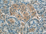 Radixin Antibody in Immunohistochemistry (Paraffin) (IHC (P))