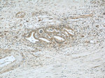 Radixin Antibody in Immunohistochemistry (Paraffin) (IHC (P))