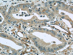 Radixin Antibody in Immunohistochemistry (Paraffin) (IHC (P))