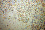 Radixin Antibody in Immunohistochemistry (Paraffin) (IHC (P))