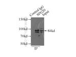 Spartin/SPG20 Antibody in Immunoprecipitation (IP)