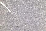 ELP2 Antibody in Immunohistochemistry (Paraffin) (IHC (P))