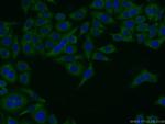 Pentraxin 3 Antibody in Immunocytochemistry (ICC/IF)