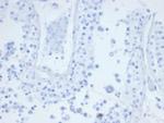 CD21 (Mature B-Cell and Follicular Dendritic Cell Marker) Monoclonal Antibody (CR2/6683)