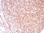 CD21 (Mature B-Cell and Follicular Dendritic Cell Marker) Recombinant Rabbit Monoclonal Antibody (CR2/8880R)