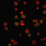 CD21 (Mature B-Cell and Follicular Dendritic Cell Marker) Recombinant Rabbit Monoclonal Antibody (CR2/3124R)