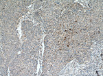 PAI-1 Antibody in Immunohistochemistry (Paraffin) (IHC (P))