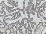 CORO2B Antibody in Immunohistochemistry (Paraffin) (IHC (P))