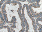 CORO2B Antibody in Immunohistochemistry (Paraffin) (IHC (P))