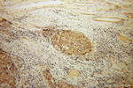 CORO2B Antibody in Immunohistochemistry (Paraffin) (IHC (P))
