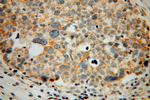 CORO2B Antibody in Immunohistochemistry (Paraffin) (IHC (P))