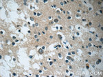 DARS2 Antibody in Immunohistochemistry (Paraffin) (IHC (P))