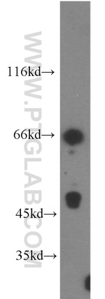 DARS2 Antibody in Western Blot (WB)