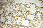 DIXDC1 Antibody in Immunohistochemistry (Paraffin) (IHC (P))