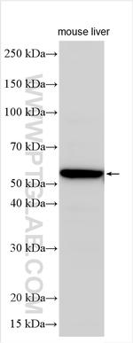 CYP4V2 Antibody in Western Blot (WB)