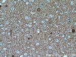 ATP6V0A1 Antibody in Immunohistochemistry (Paraffin) (IHC (P))