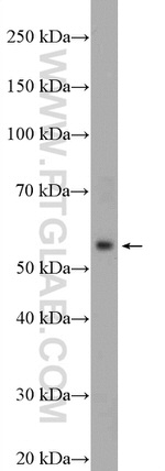 HTR7 Antibody in Western Blot (WB)