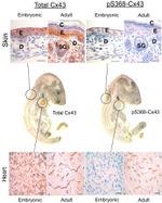 Connexin 43 Antibody in Immunohistochemistry (Paraffin) (IHC (P))