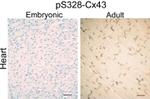 Connexin 43 Antibody in Immunohistochemistry (Paraffin) (IHC (P))