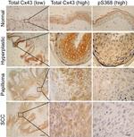 Connexin 43 Antibody in Immunohistochemistry (Paraffin) (IHC (P))