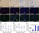 N-cadherin Antibody in Immunohistochemistry (IHC)
