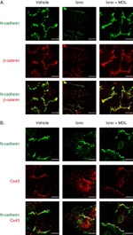 N-cadherin Antibody in Immunocytochemistry (ICC/IF)