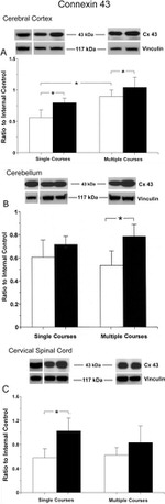 Connexin 43 Antibody in Western Blot (WB)