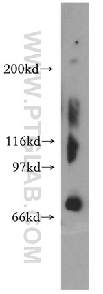 TIGD1 Antibody in Western Blot (WB)