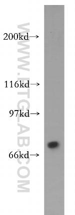 TIGD1 Antibody in Western Blot (WB)