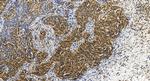 SETX Antibody in Immunohistochemistry (Paraffin) (IHC (P))