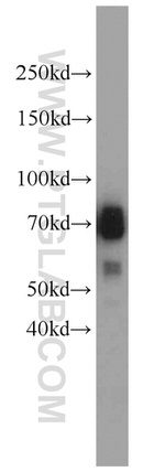TCF7L2 Antibody in Western Blot (WB)