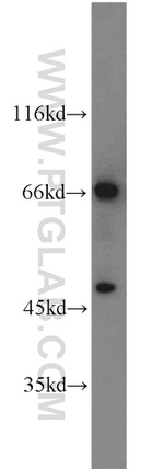 TCF7L2 Antibody in Western Blot (WB)