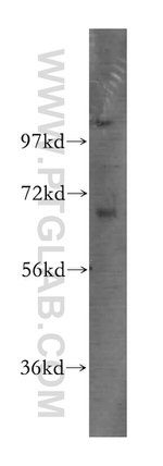 TCF7L2 Antibody in Western Blot (WB)