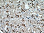 TAC1 Antibody in Immunohistochemistry (Paraffin) (IHC (P))