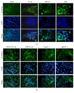 beta Catenin Antibody in Immunocytochemistry (ICC/IF)