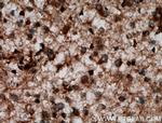 JAKMIP1 Antibody in Immunohistochemistry (Paraffin) (IHC (P))