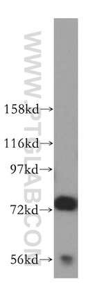 JAKMIP1 Antibody in Western Blot (WB)