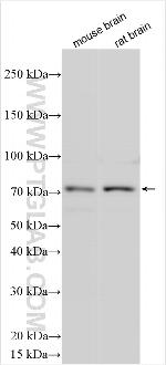 ACSL6 Antibody in Western Blot (WB)